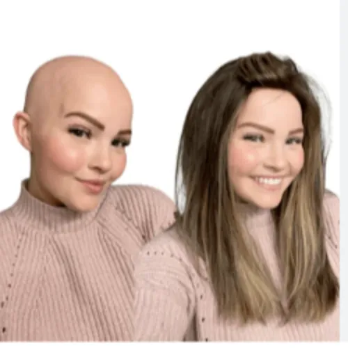 Medical Grade Hair Wigs